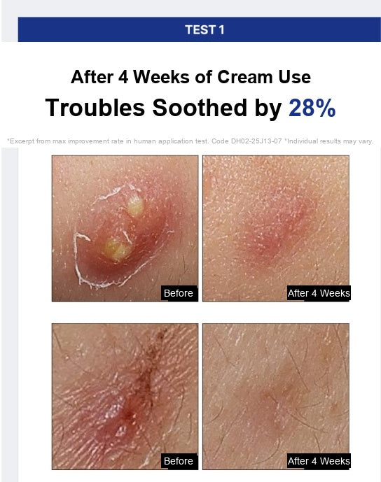 Anti-Cne Repair Clear Cream 40ml - Blemish & Barrier Recovery