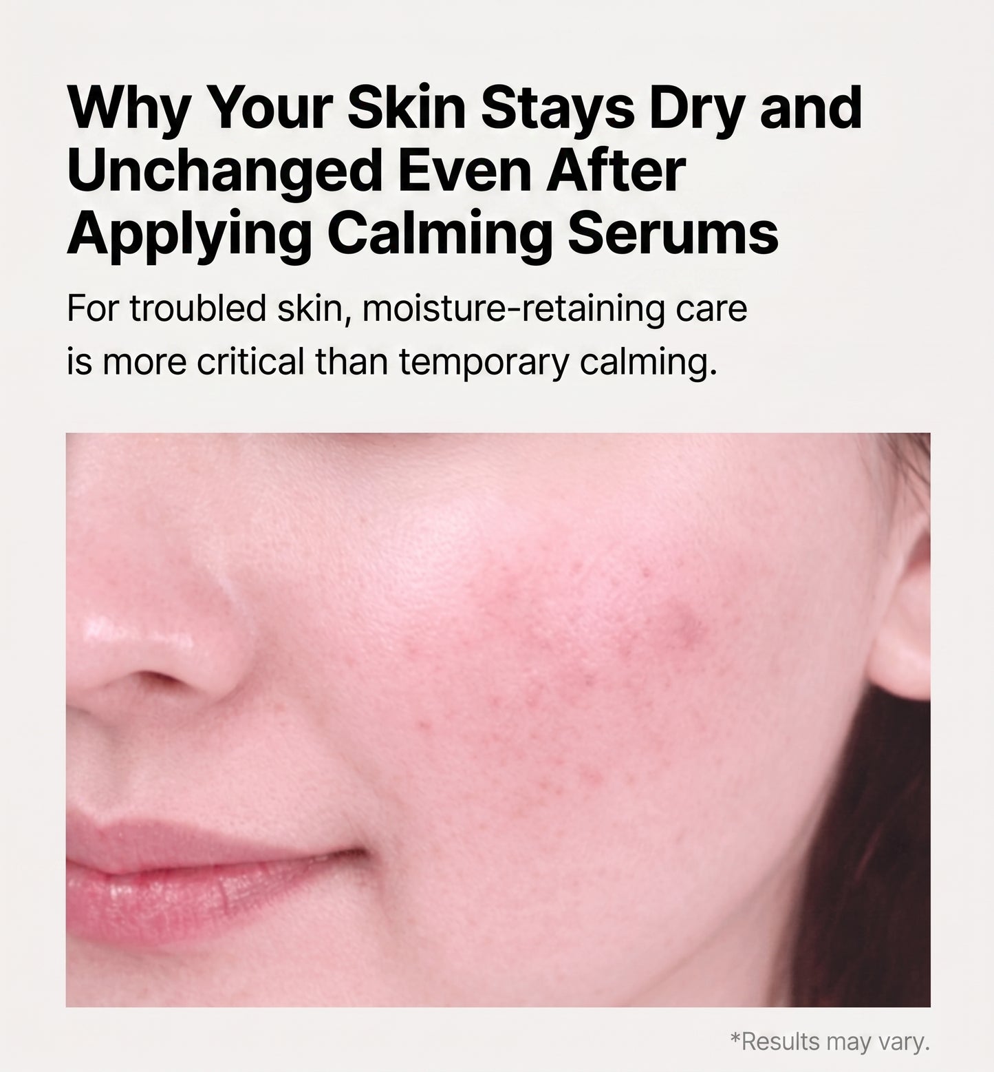 Anti-Cne Calming Potion 50ml - Rapid Blemish & Redness Relief