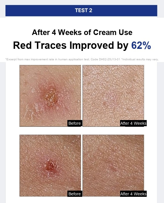 Anti-Cne Repair Clear Cream 40ml - Blemish & Barrier Recovery