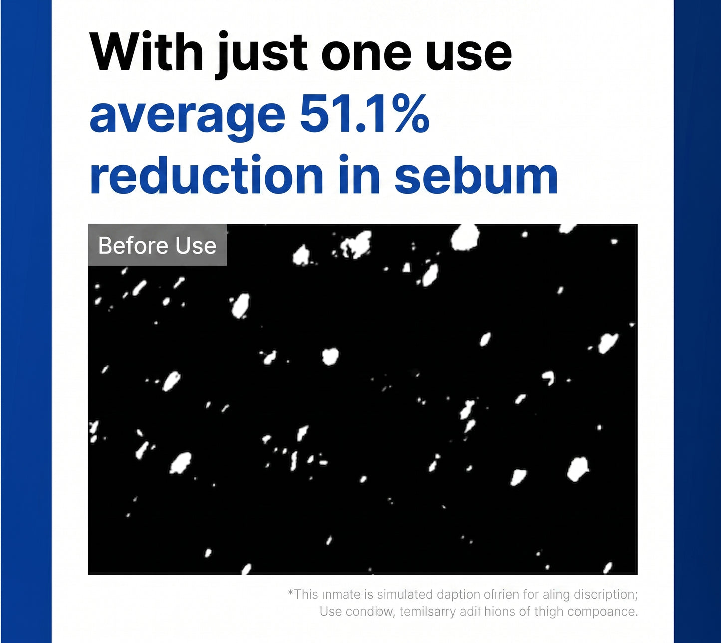 Anti-Cne Serum Reducer 300ml - Target Blemishes & Restore Clarity